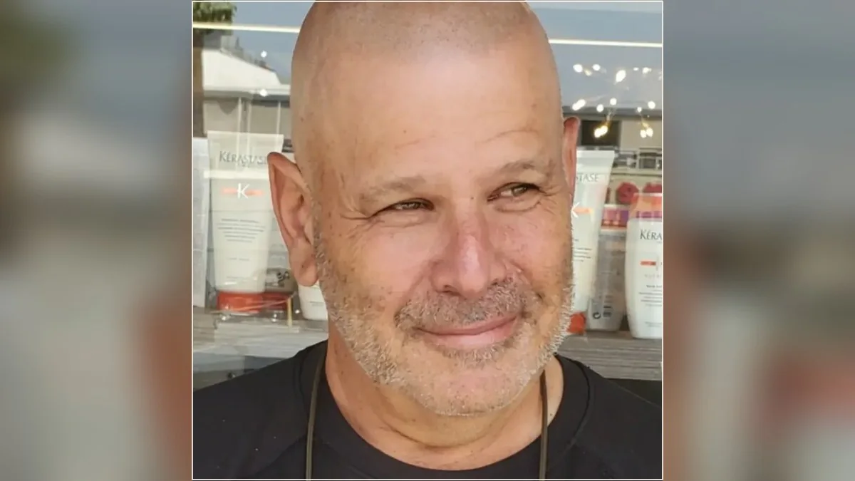 Scalp micropigmentation result showing the hairline and scalp from the HairDot.Ink gallery