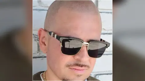 Scalp micropigmentation result showing the hairline and scalp from the HairDot.Ink gallery