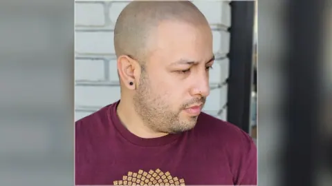 Scalp micropigmentation result showing the hairline and scalp from the HairDot.Ink gallery
