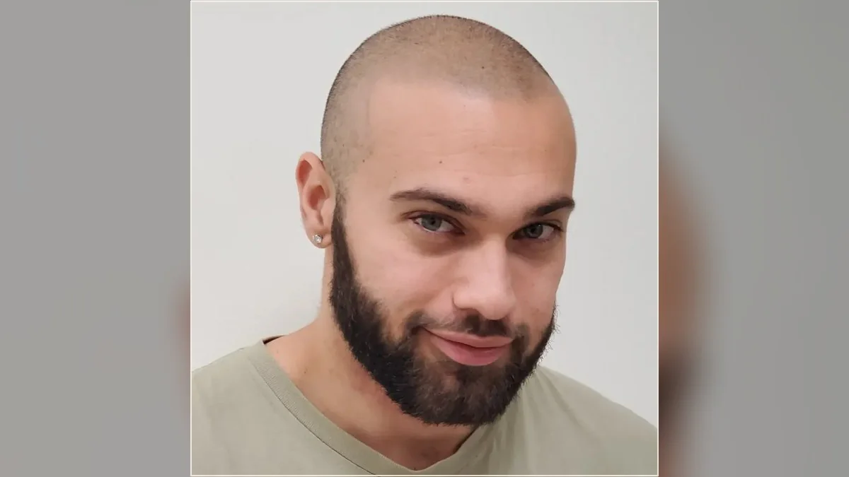 Close view of a shaved hairline from the HairDot.Ink website