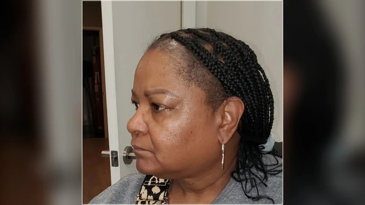 Women's scalp micropigmentation photograph showing existing hair and scalp coverage from the HairDot.Ink gallery