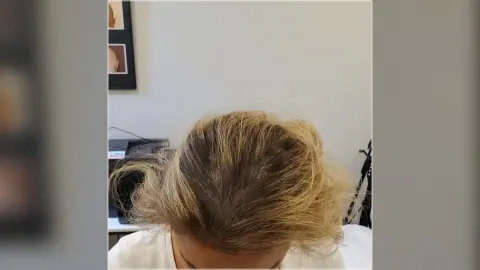 Women's scalp micropigmentation photograph showing existing hair and scalp coverage from the HairDot.Ink gallery