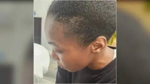 Women's scalp micropigmentation photograph showing existing hair and scalp coverage from the HairDot.Ink gallery