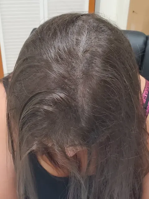 HairDot SMP comparison 3, after