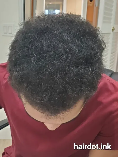 HairDot SMP comparison 4, after