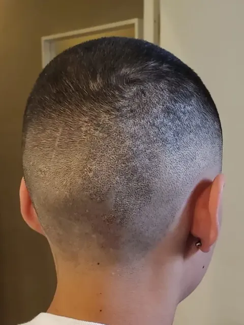 HairDot SMP comparison 5, after