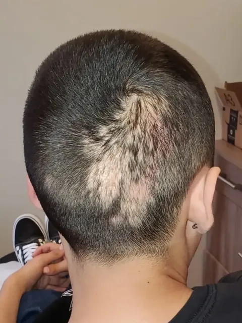 HairDot SMP comparison 5, before