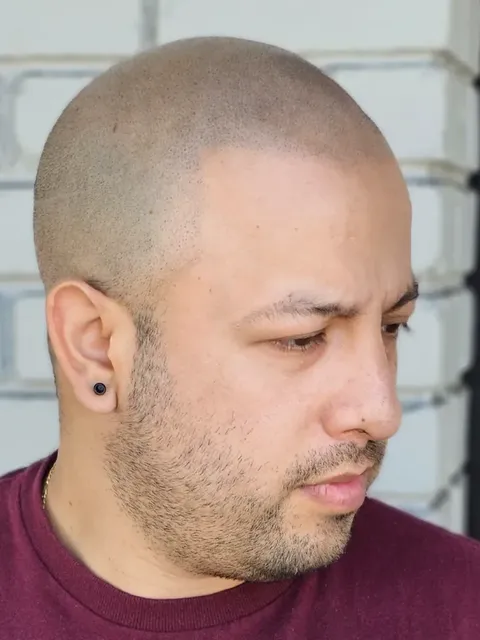 HairDot SMP comparison 8, after