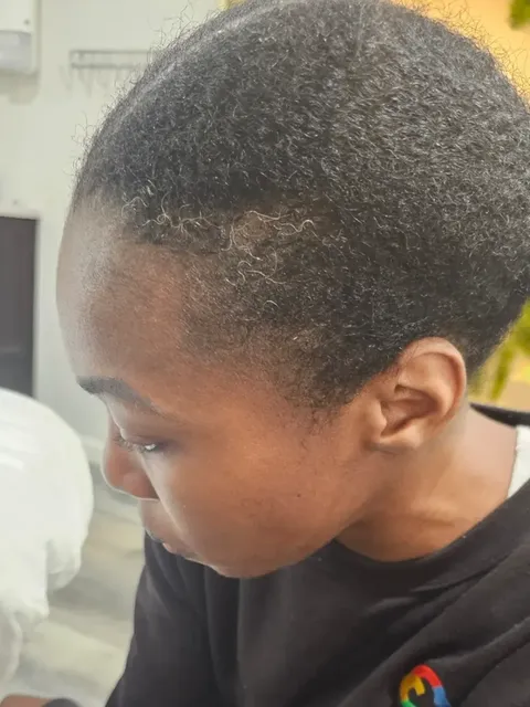 HairDot SMP comparison 15, after