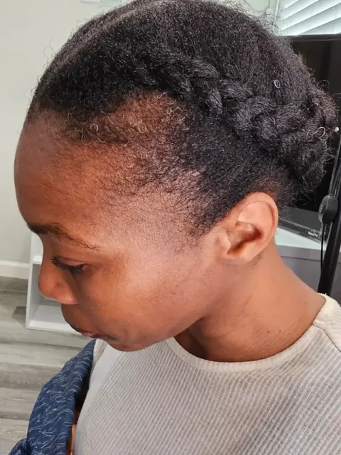 HairDot SMP comparison 15, before