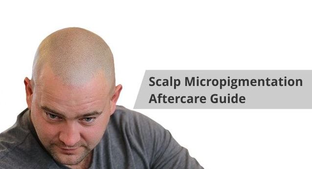 scalp micropigmentation aftercare